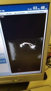 nukescan